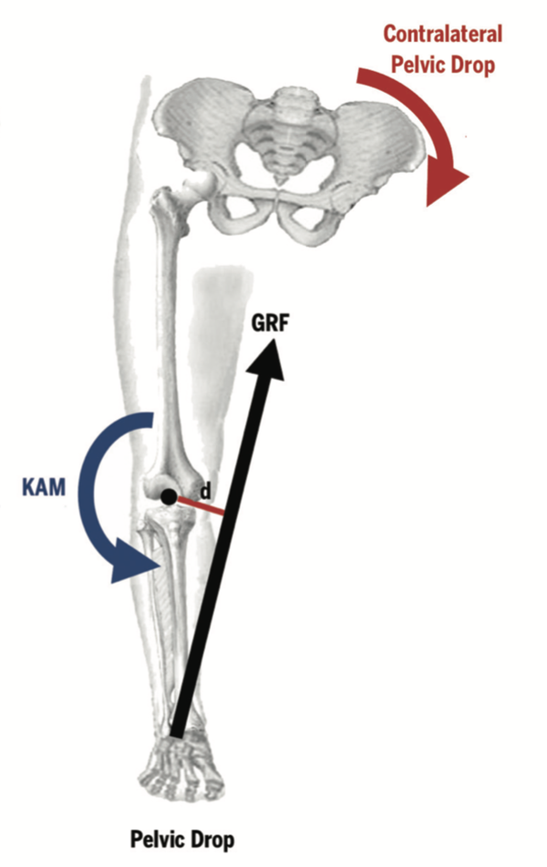 膝痛误区全面解答