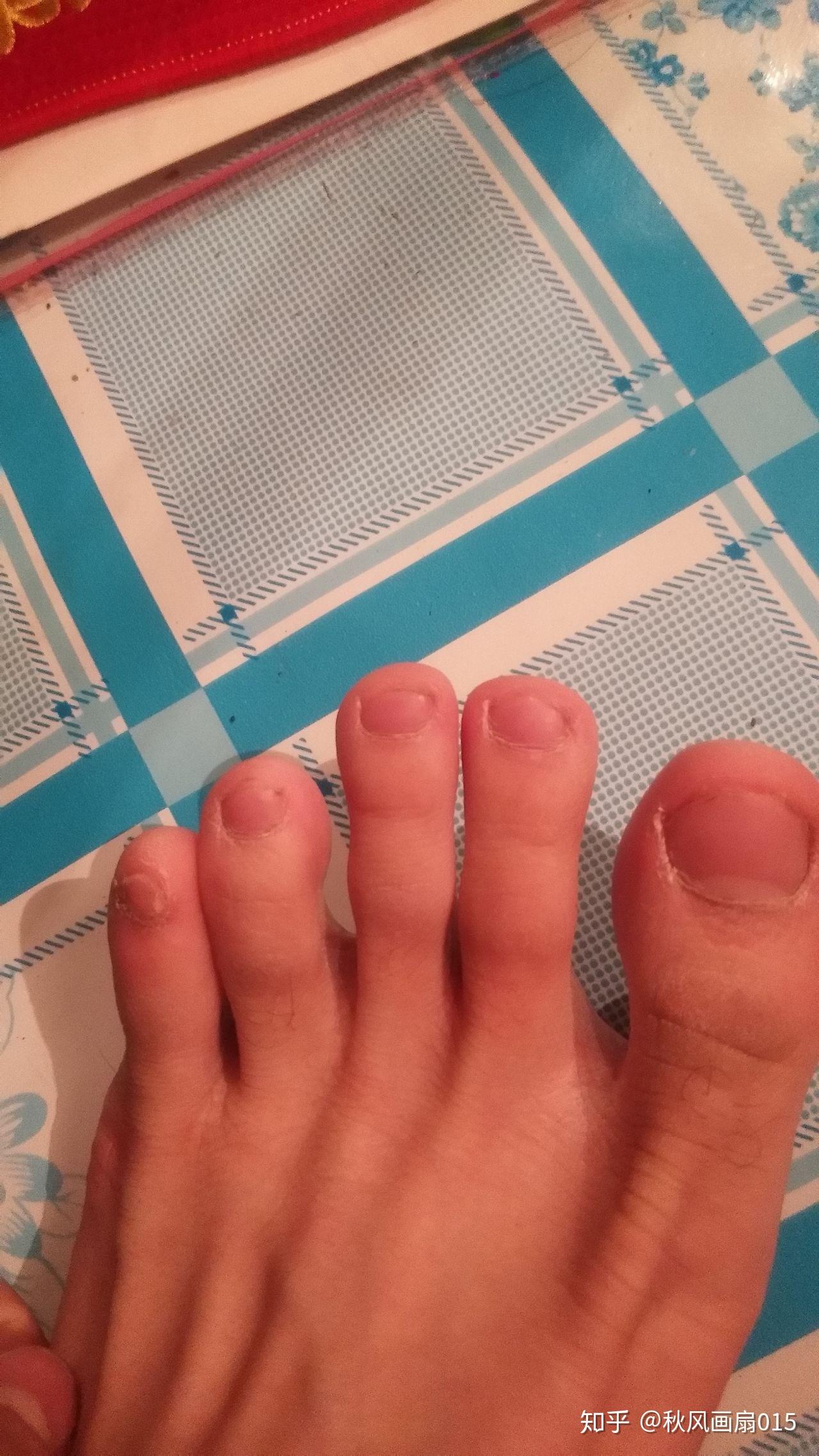 有没有中间脚趾最长的 - 知乎