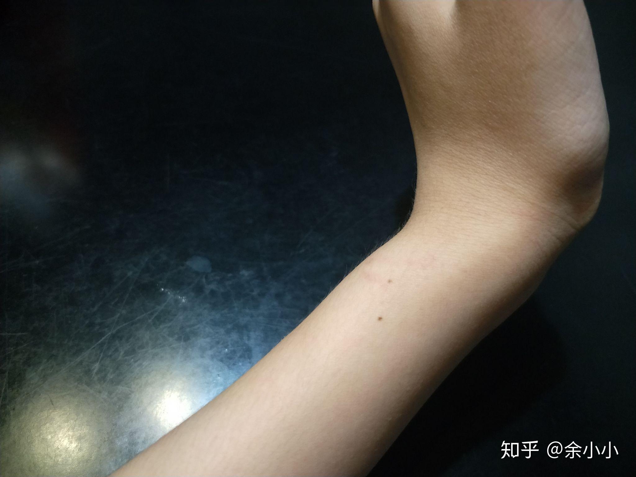 男朋友有抑郁症怎么办