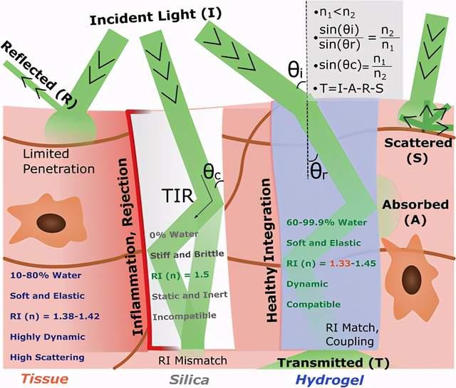 先進材料綜述工程水凝膠的生物醫學光子學設計製造和應用