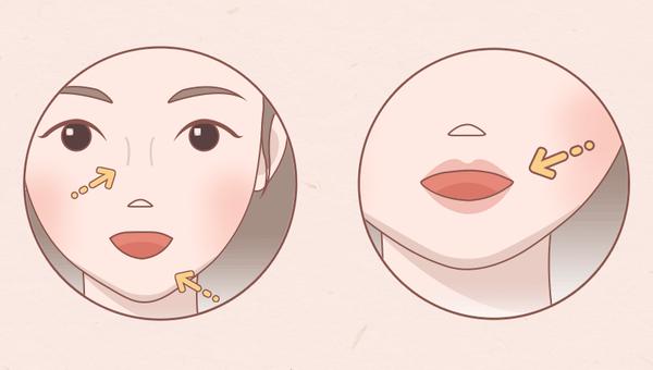 做完面部填充,脸竟然小一圈? - 知乎