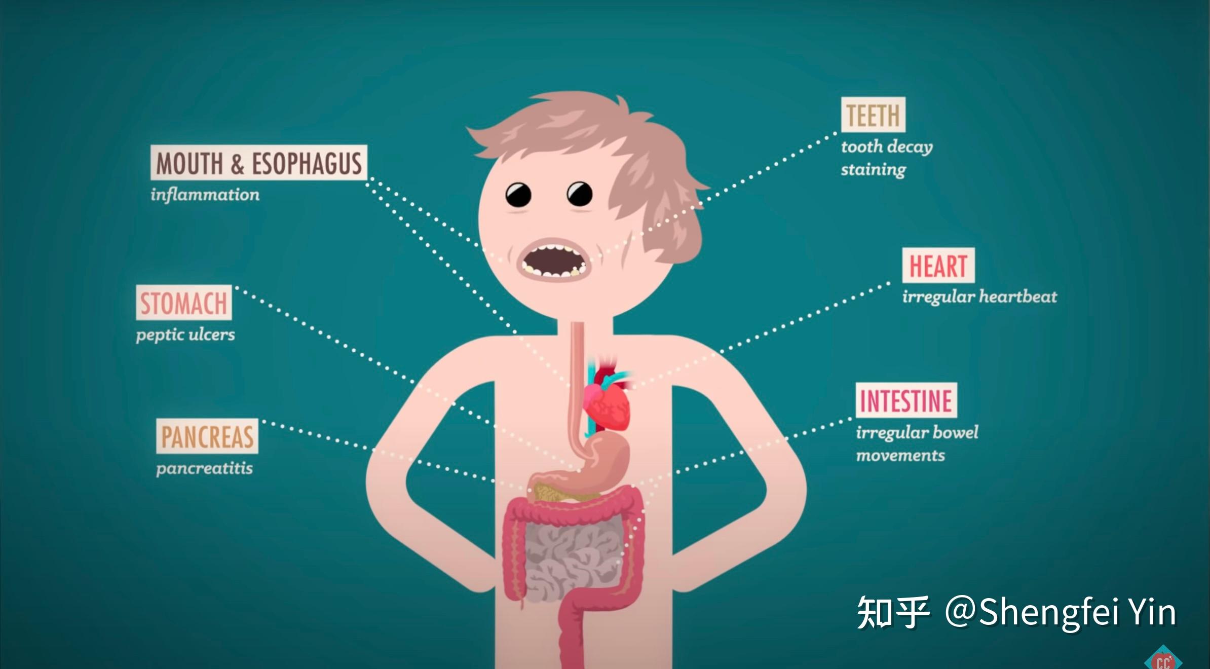 Eating And Body Dysmorphic Disorders Crash Course Psychology 33 知乎 