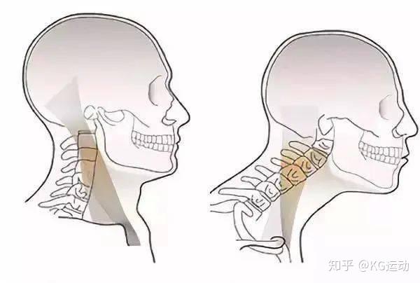 头前伸太毁气质！三个动作帮你改善 - 知乎