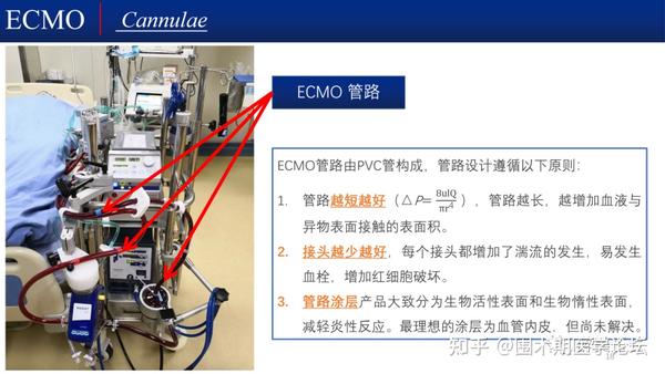 课件分享丨ECMO患者围术期麻醉管理 - 知乎