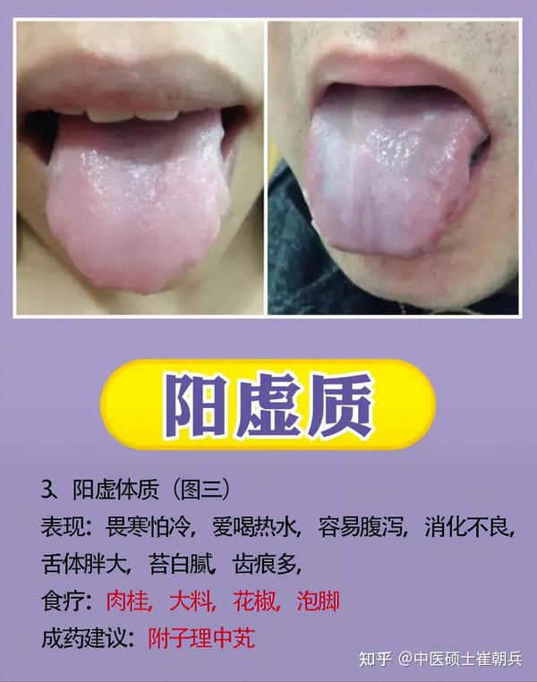 分享9种体质舌象，让老中医教你辨证，后面给你解决方法 - 知乎