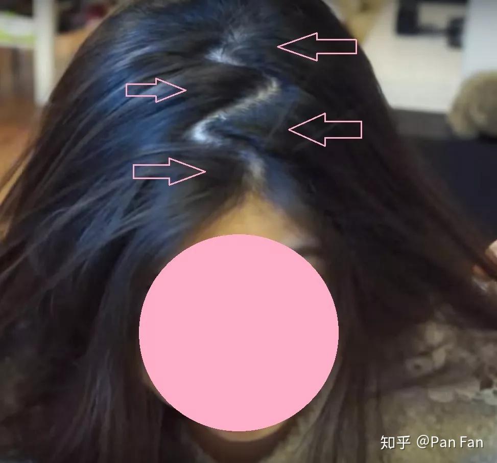 你的头脸到底适合偏分中分还是大旁分?这样判断错不了 - 知乎