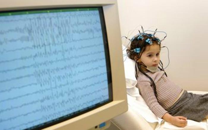 脑电图报告不是疾病诊断书为何还要做脑电图检查