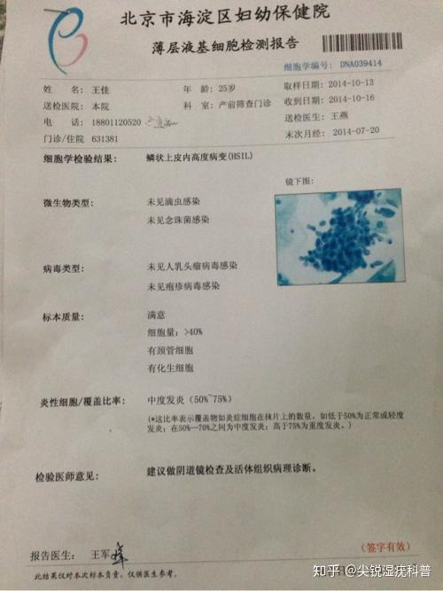 tct是宫颈癌筛查最先进的检测技术