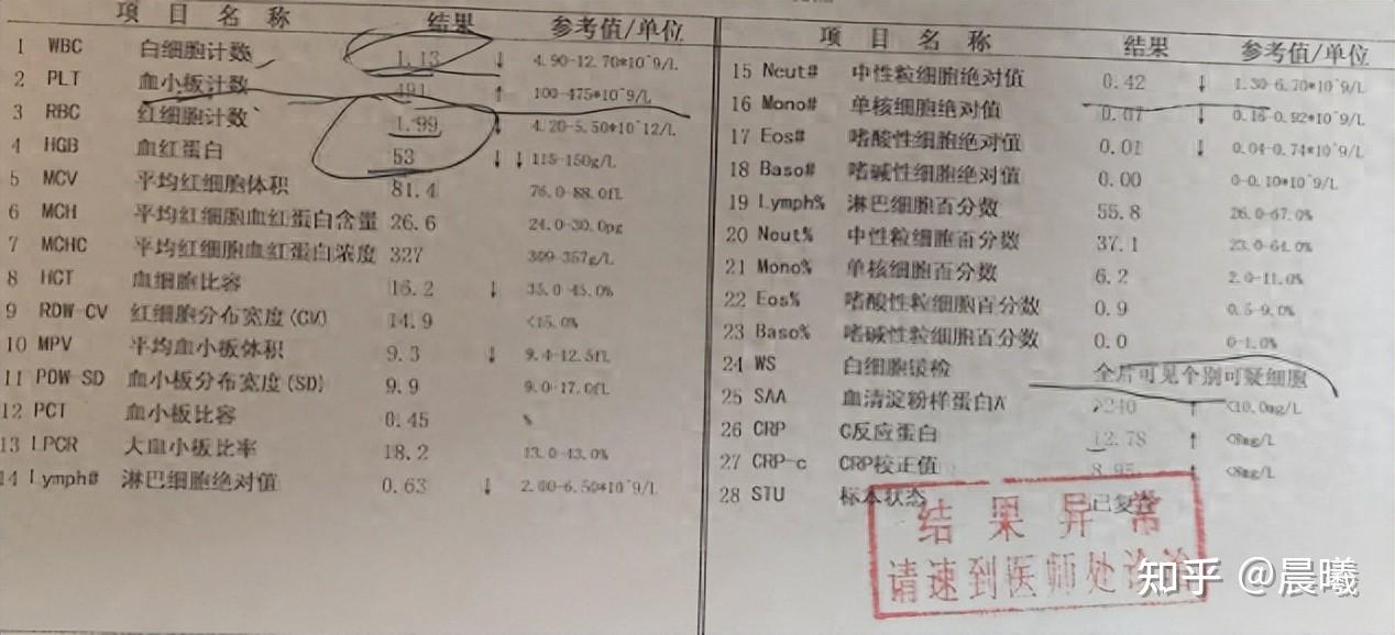 白血病怎么检查图片