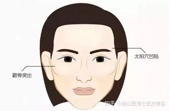 婴儿左右侧躺会导致太阳穴凹陷吗 v2-9dc337ebda1abc4ddbc9509a38b78fe3_r.jpg