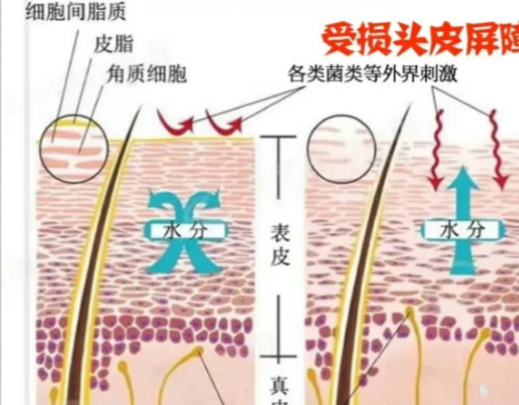 对于头皮的养护