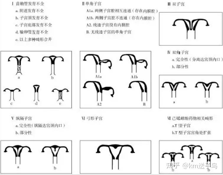 双阴道双子宫，与正常女性有何差别？ - 知乎