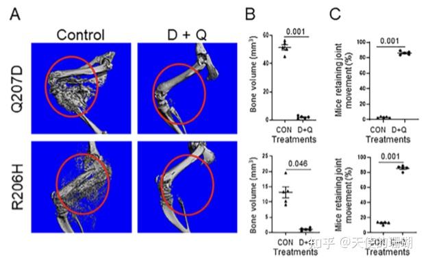 plus quercetin (d q) ameliorates ho in two fop mouse models