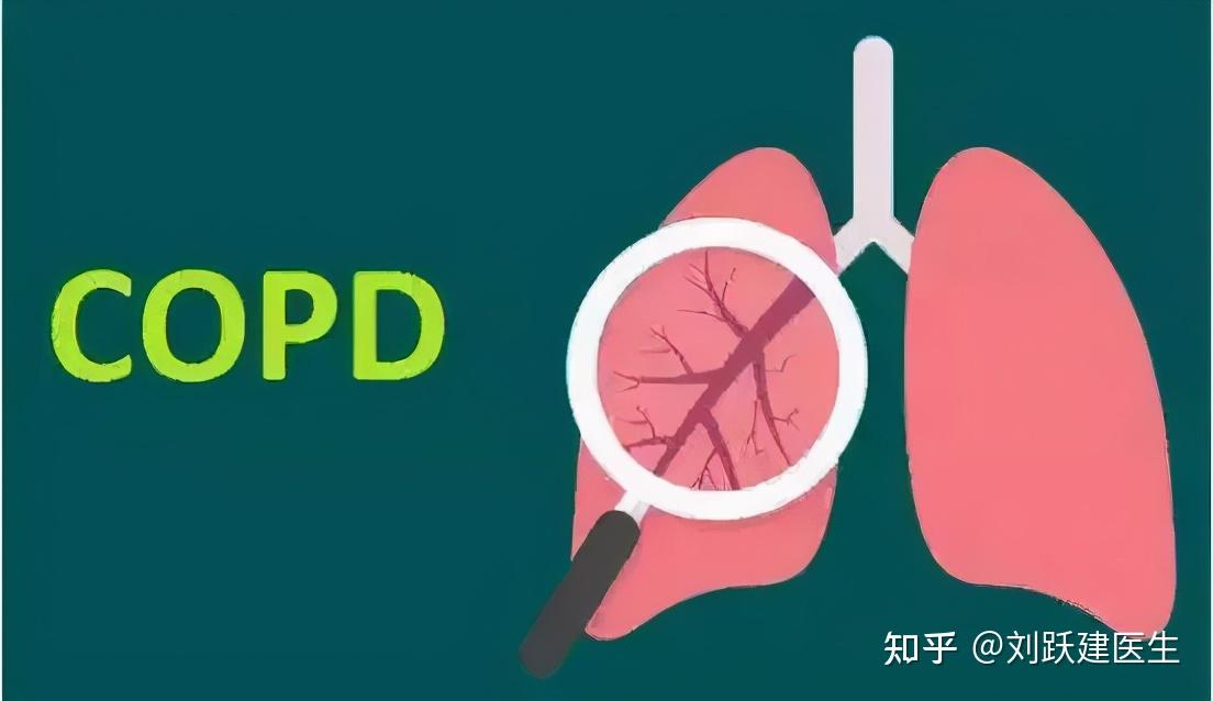 慢阻肺又称(copd)因早期不易被发觉,发现已是中晚期故有"沉默的杀手"