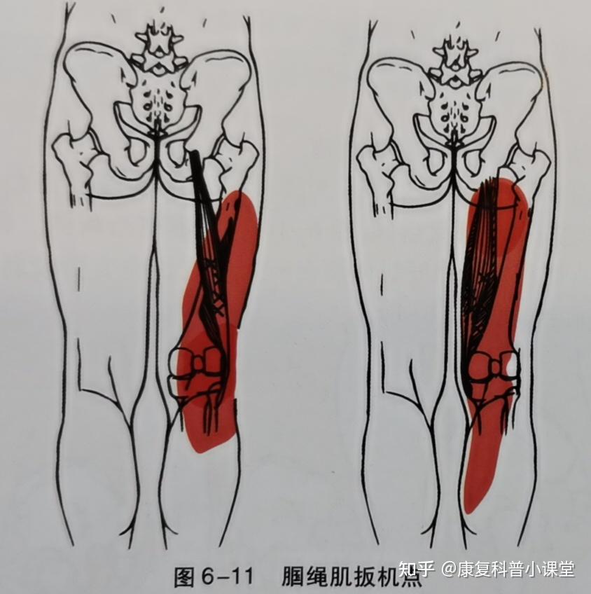 方法:檢查者面對受檢者站立,手指觸及髂前上棘,手指沿髂骨前面向內