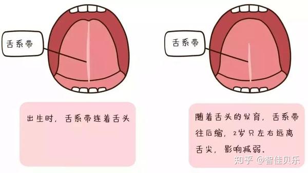 孩子说话不顺，要剪舌筋，真的有必要吗？ - 知乎