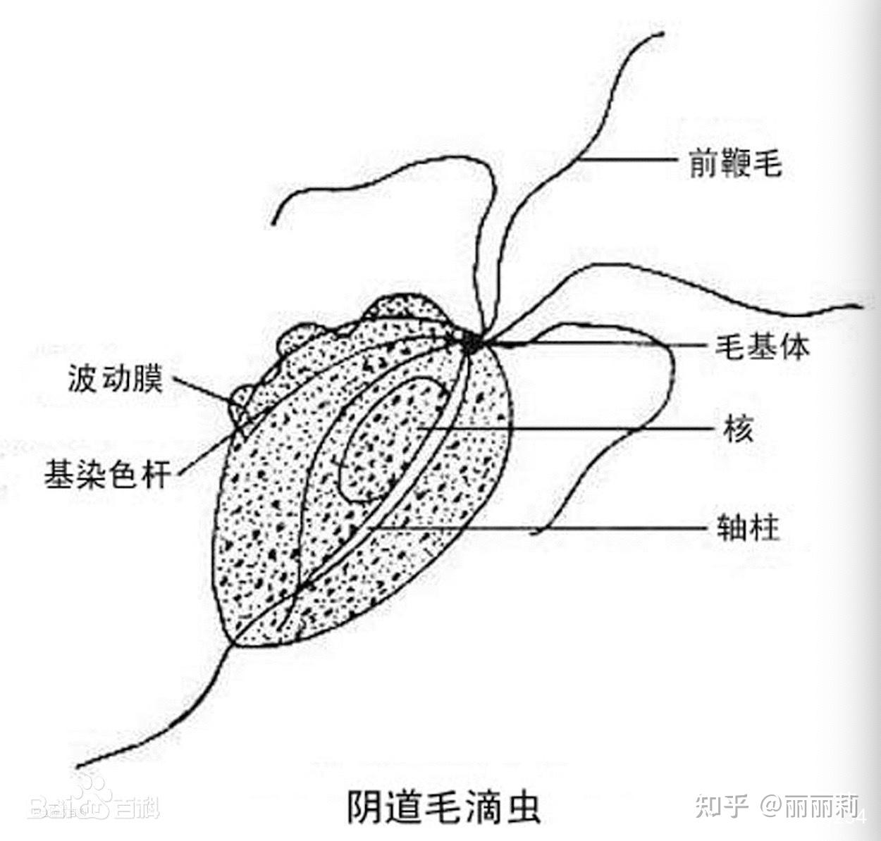 女性滴虫病的症状样子图片