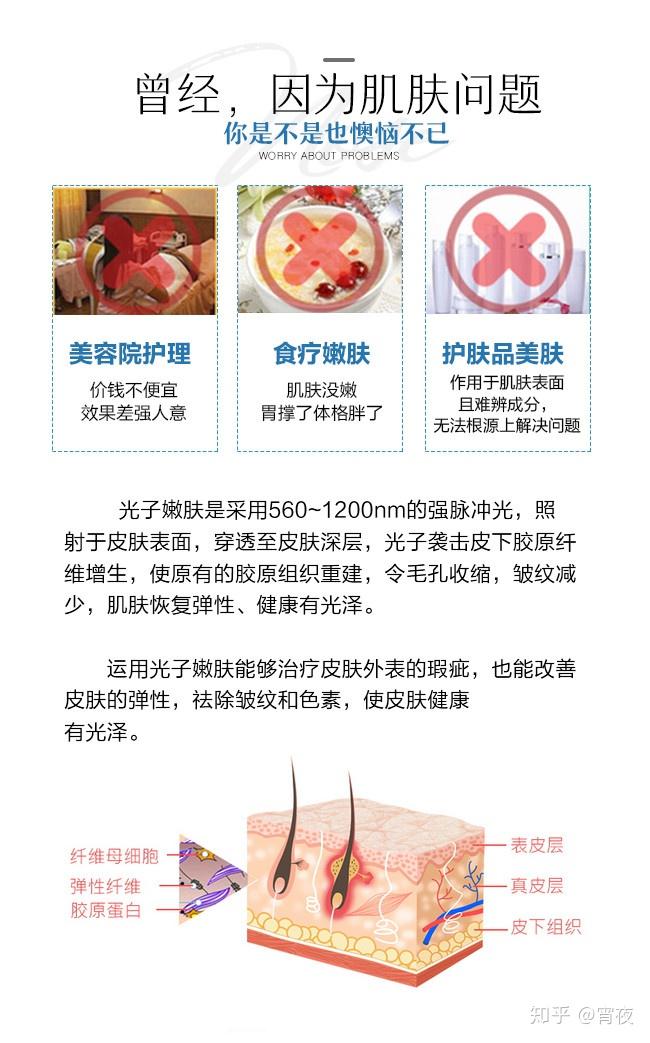 医美入门级项目光子嫩肤你了解多少