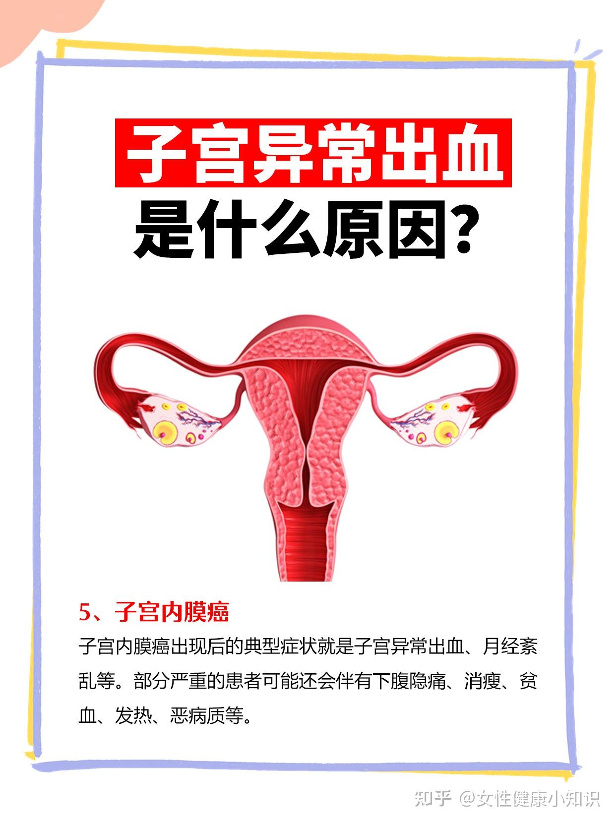 子宫异常出血是什么原因株洲现代女子医院为你科普
