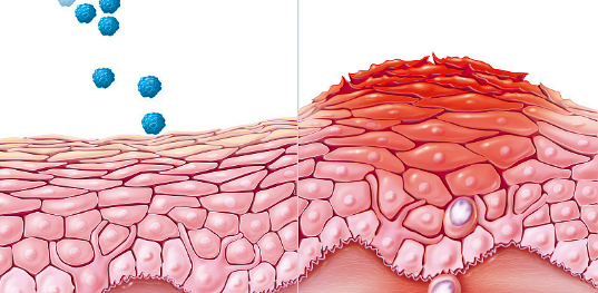 龟头上长红点红斑是怎么回事