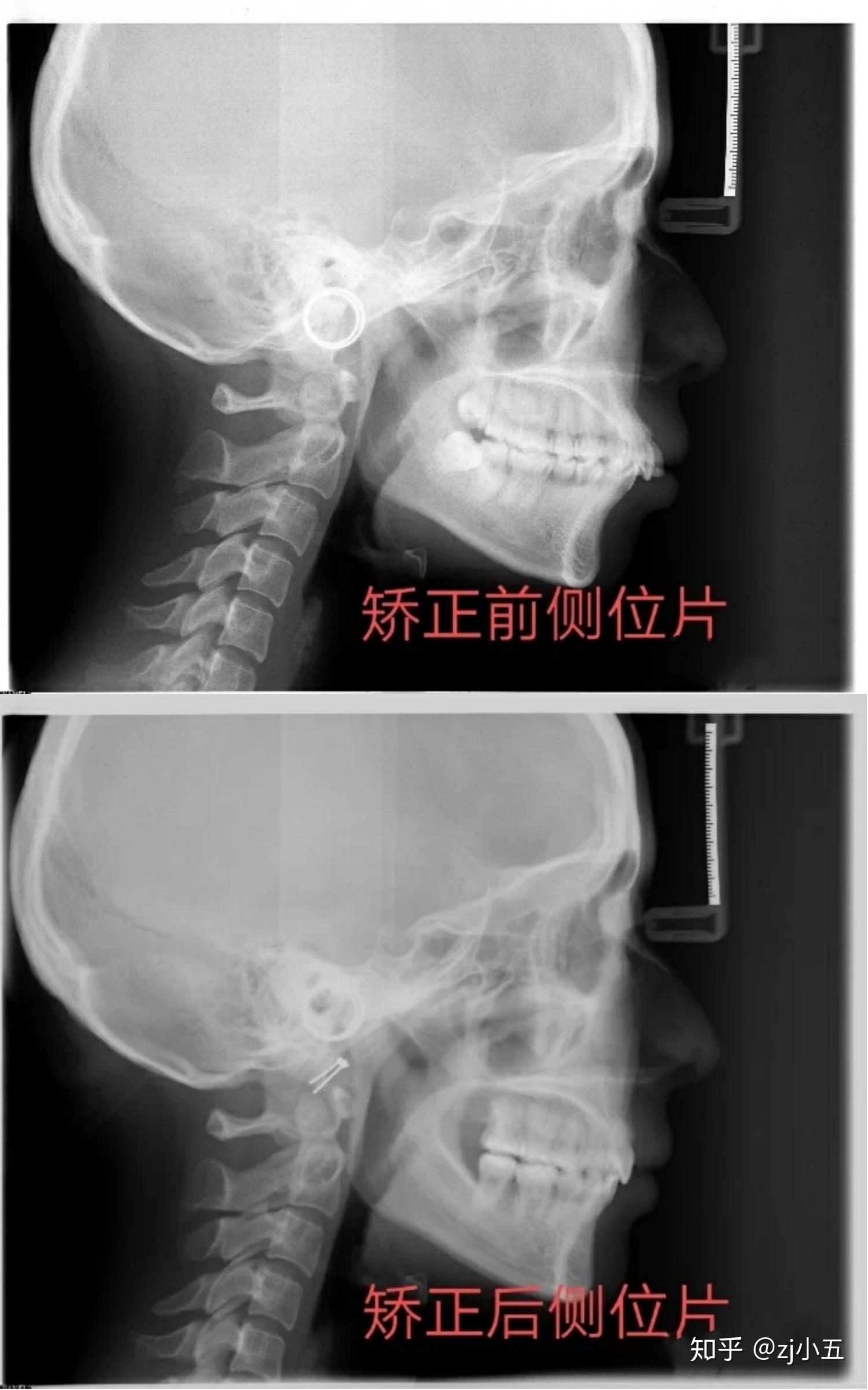 杭州口腔医院城西分院-牙齿矫正 - 知乎