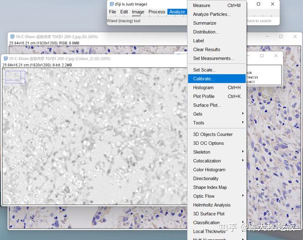 如何使用image j定量免疫组化阳性区域 知乎