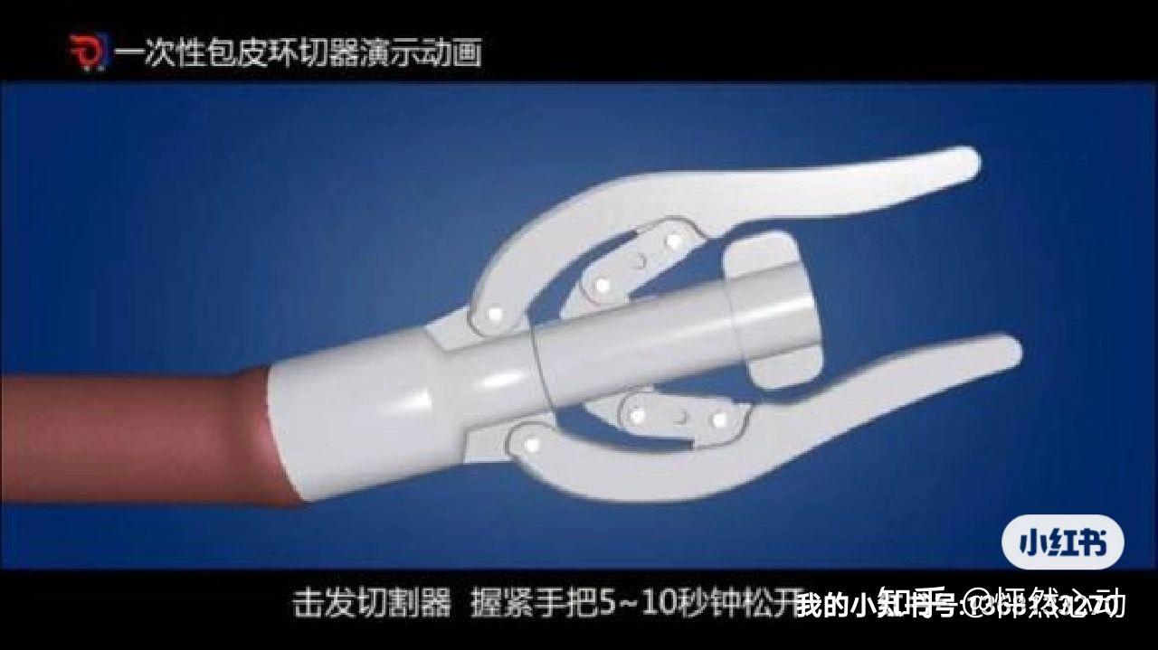 ge包皮经验贴 - 知乎