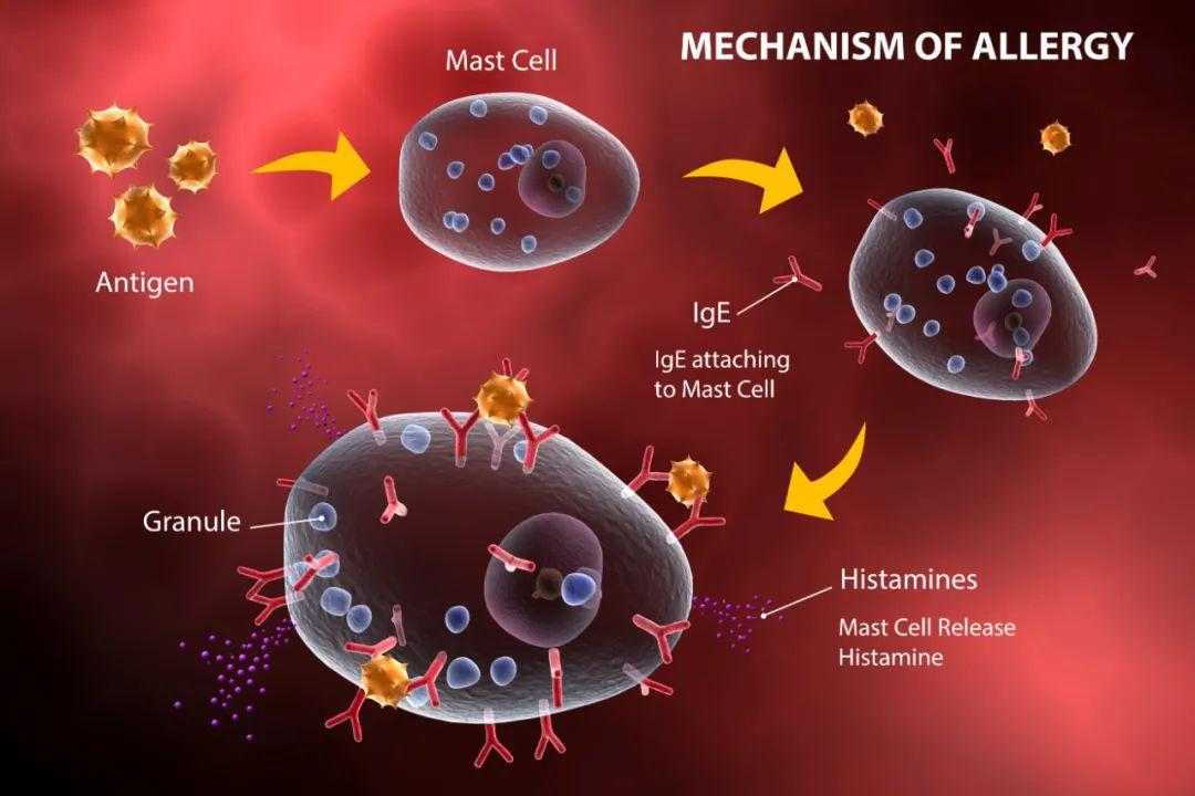 肥大细胞活化综合征