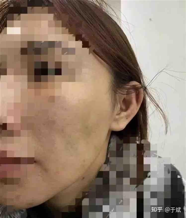 西安美莱医美被曝惊心内幕:18名手术医生半数资质“注水”(图2)
