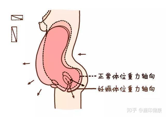 骨盆痛是什么症状 v2-9fe189c8567c98d8e40934f615008eff_r.jpg