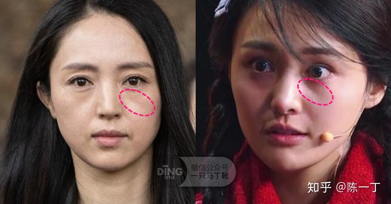 一脸苦相的容貌有何特征