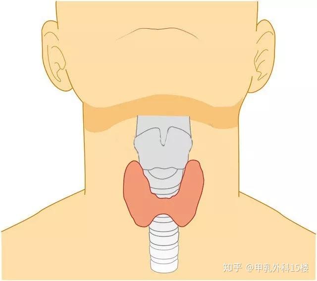 每10個人體檢中就有1人查出甲狀腺結節到底該不該切臨床醫生觀點參考