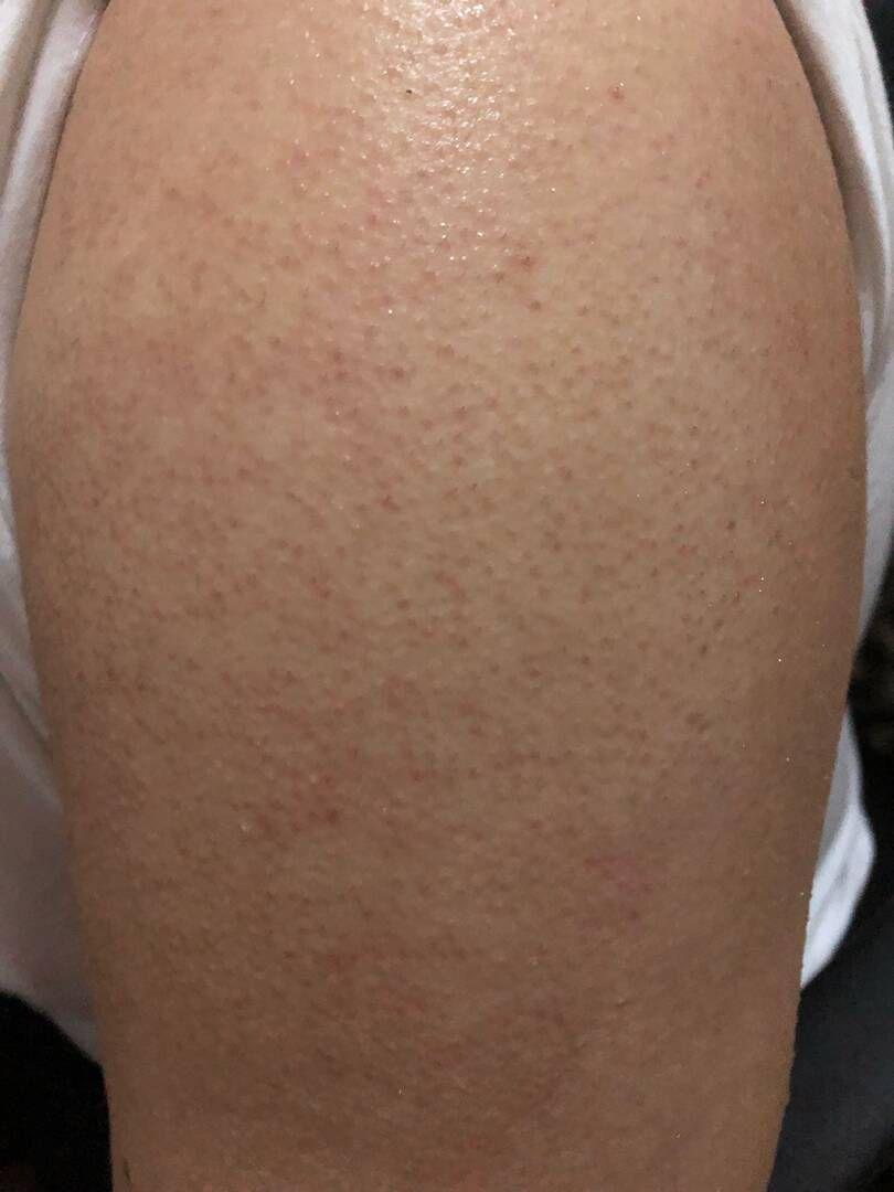 治鸡皮肤怎么找到适合风格(治鸡皮肤怎么找到适合风格的医生)