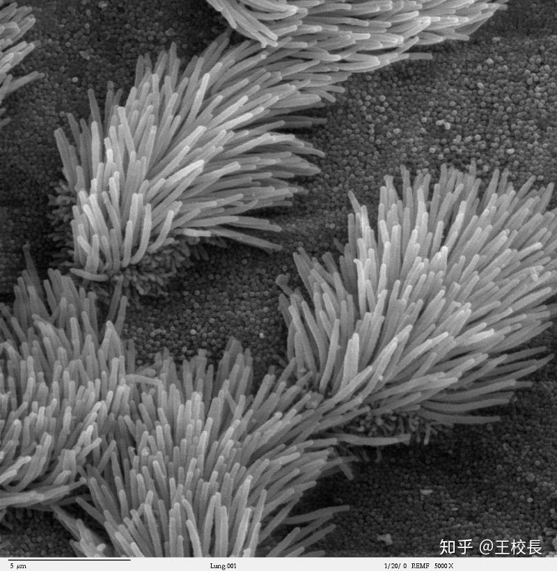 口干喉咙干鼻子干 v2-a06054d7a91362770254063c1f280ae3_r.jpg
