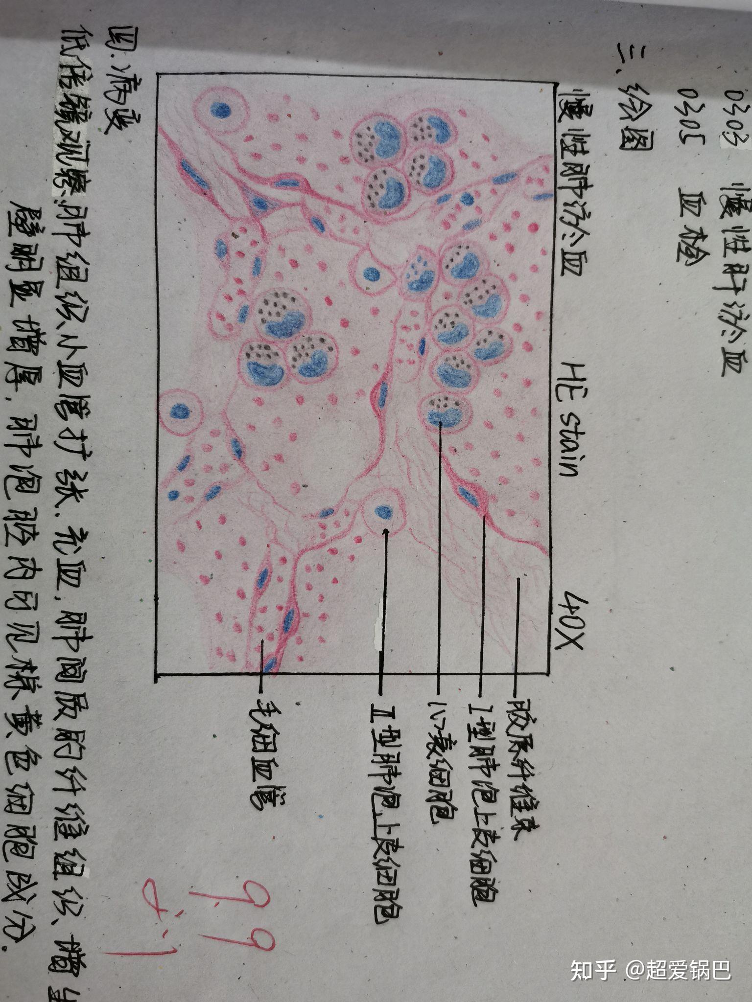 肝血窦手绘图图片