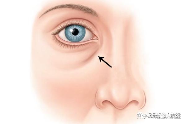 挑战减龄十岁 ,衰老那都不是事!!! - 知乎