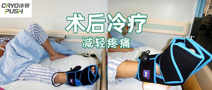 [术后患者]持续冷疗减轻70%的水肿疼痛【冰恒医用冷敷】 - 知乎