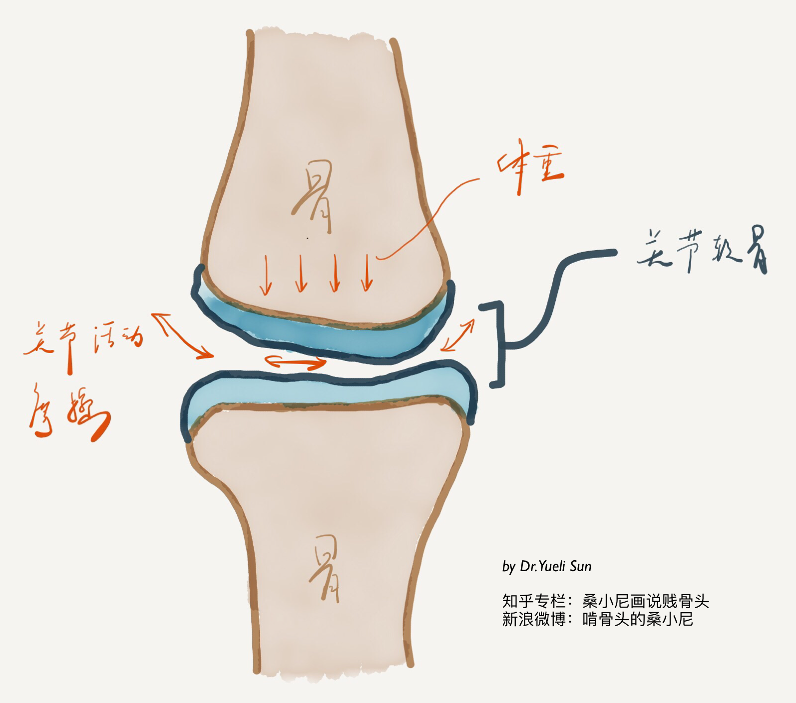 重新认识「膝骨关节炎」——手绘插图多到爆炸的一期Live文字整理稿 - 知乎