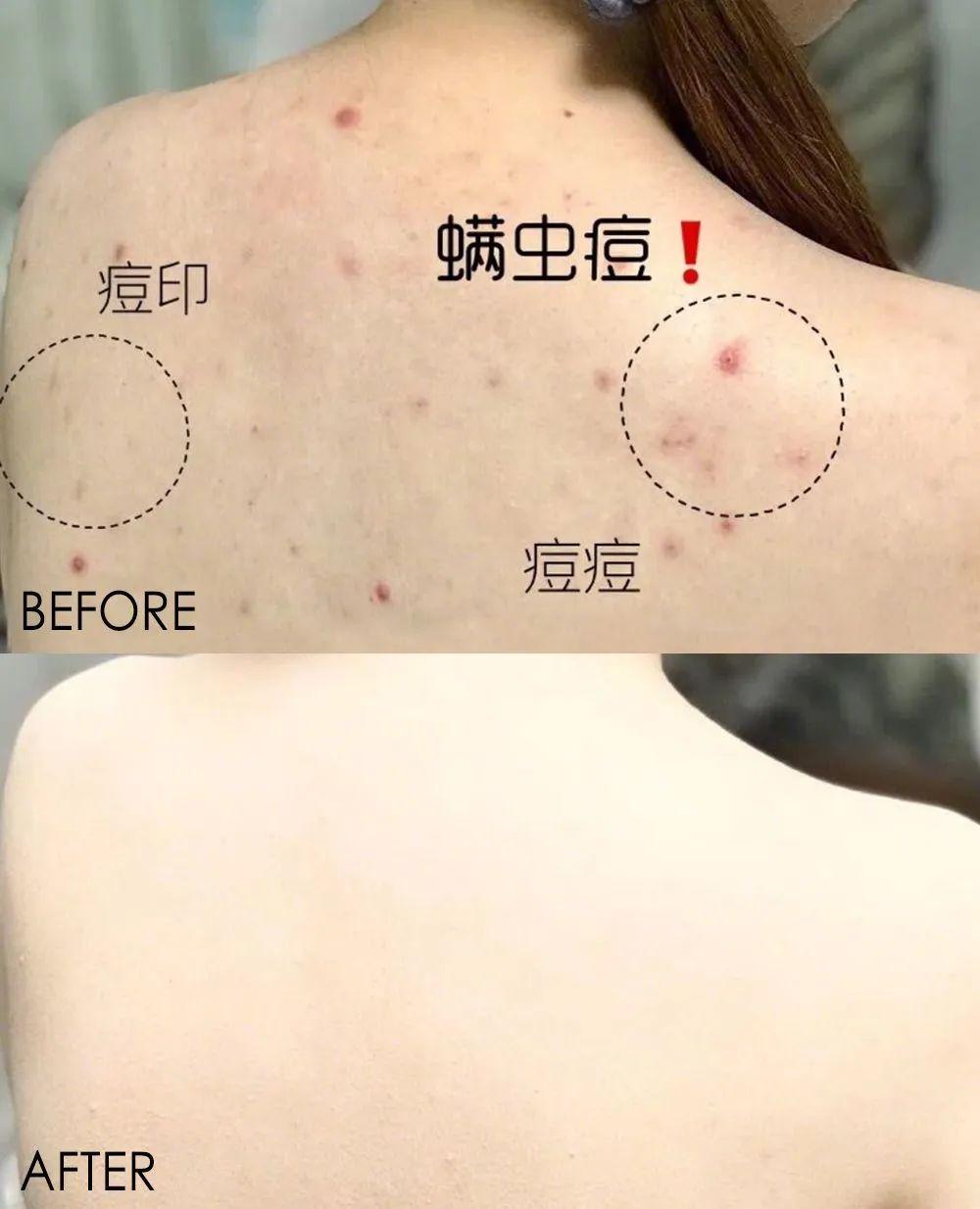 换季时间到对抗螨虫全靠它