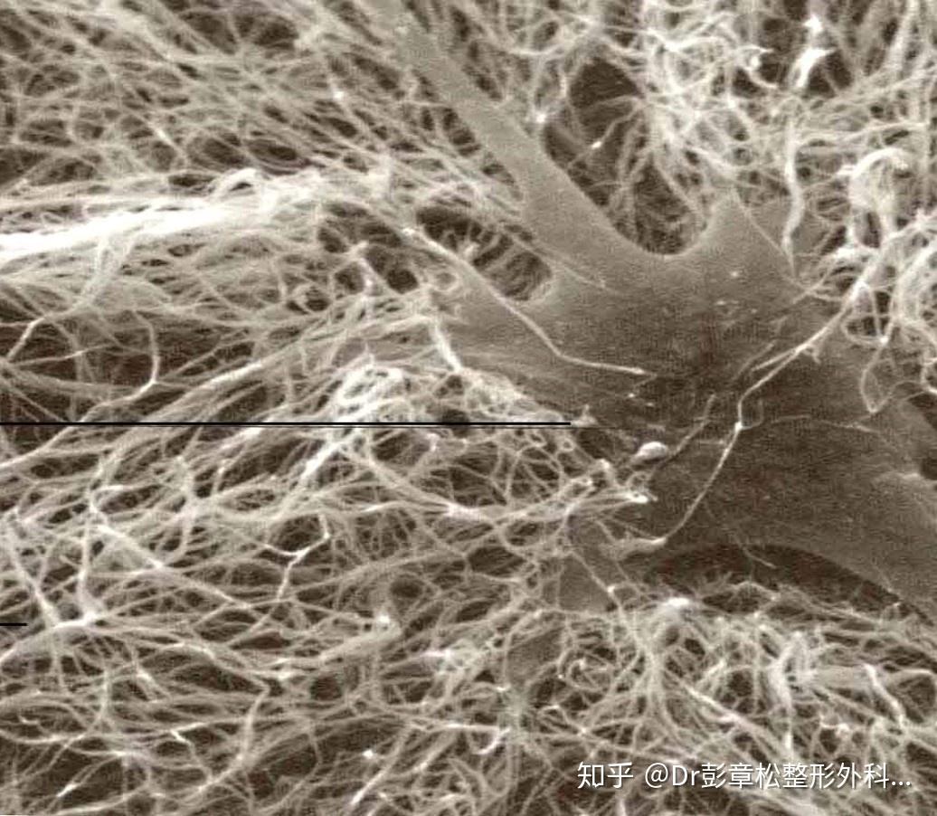 真皮层主要由纤维和纤维细胞构成,纤维的构成中主要包括胶原纤维(最为