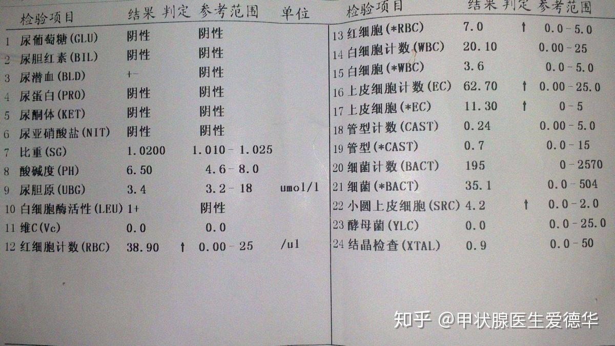 腰痛尿頻尿急尿血尿路結石離你可能不遠了