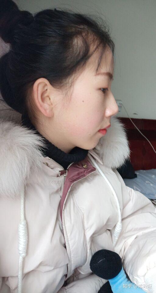 脸鼓没下巴的姑娘怎么变美?是不是没救了…?