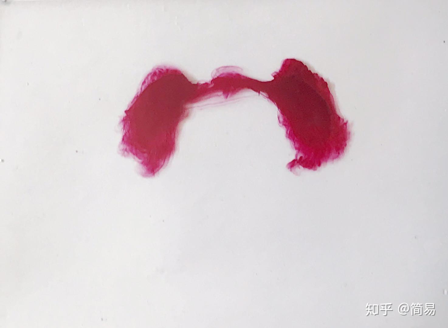《红 肺 知乎