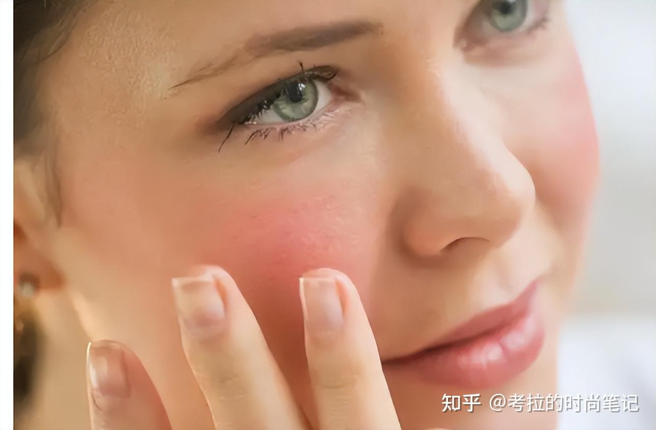 夏天容易"脸红"?教你3个改善红脸蛋的技巧,简单有效值得收藏