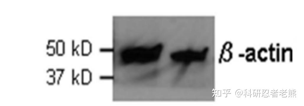 Western blot 实验大忌——稀里糊涂跑内参蛋白 - 知乎