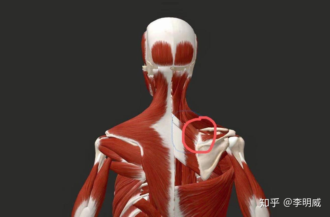 2 第二个案例是右侧肩胛骨上角疼痛,就是这个地方:操作过程没有来得及