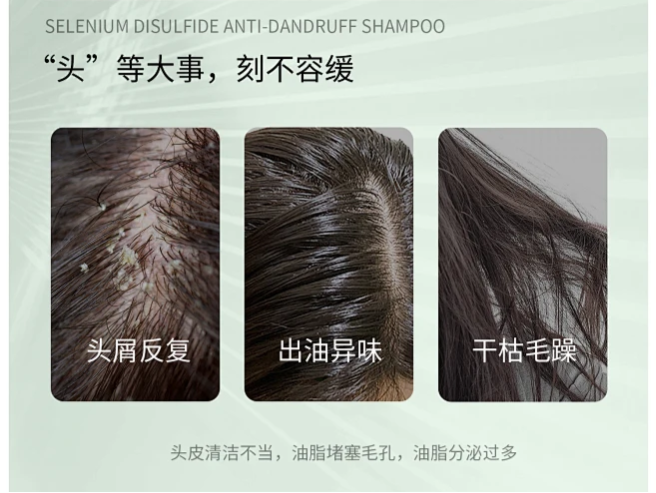头皮出现什么症状，就可以刷酸了？ - 知乎