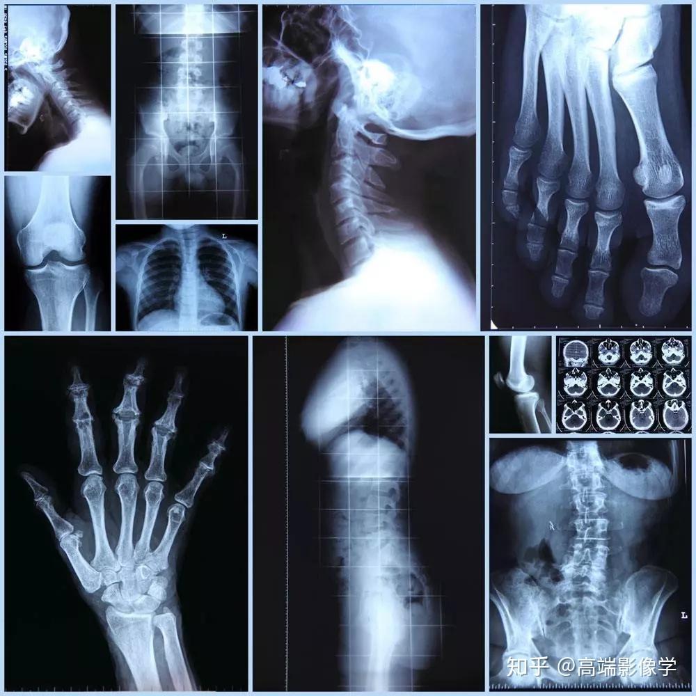 知识贴:x光,ct,b超,磁共振,区别到底在哪?了解这些才能对号入座