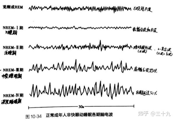 脑电活动及睡眠与觉醒 知乎 脑电活动及睡眠与觉醒 知乎