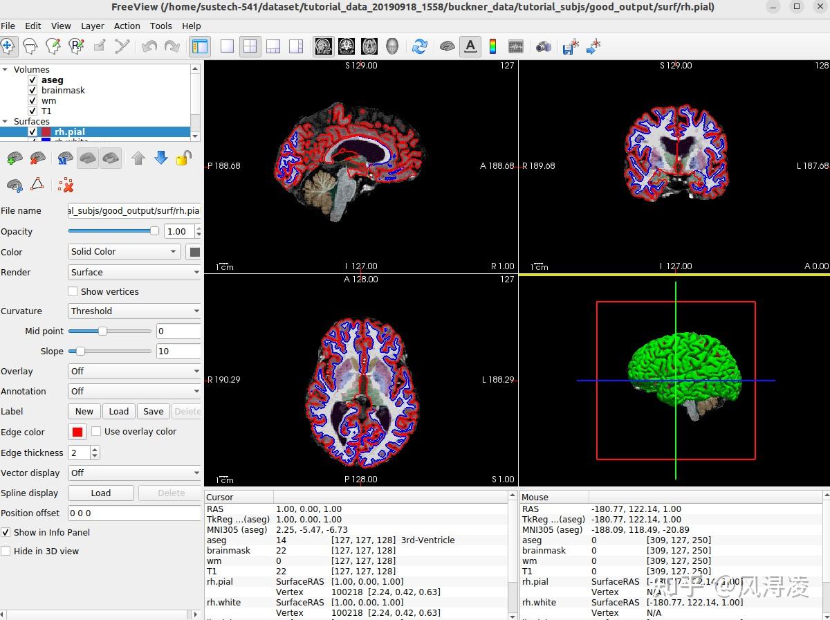 Freesurfer下载安装，常用术语和recon-all命令 - 知乎